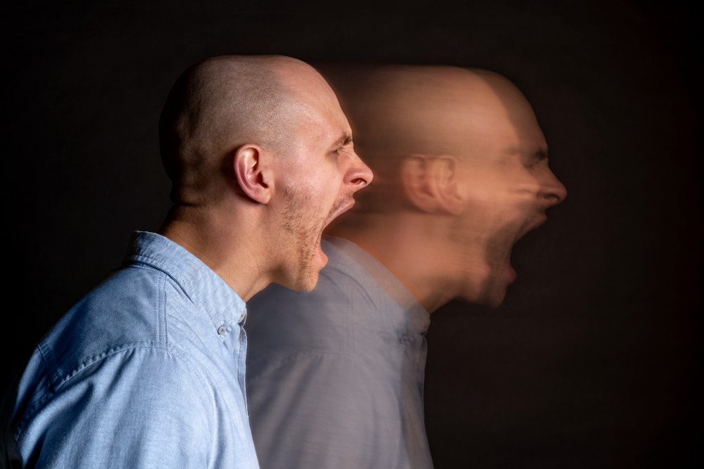 Bipolar Disorder image